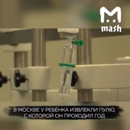 В Москве у ребенка извлекли пулю, с которой он проходил год
